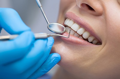 Woman in dental chair for preventive appointment. 