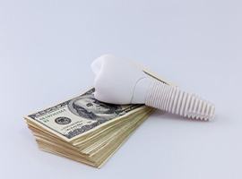 A dental implant laying on a stack of paper money