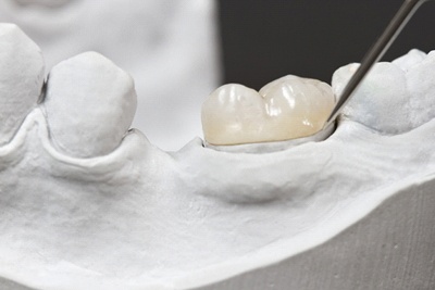 A porcelain dental crown