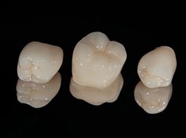 Dental crowns