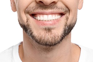 close-up of a man smiling with dental implants in Crown Point