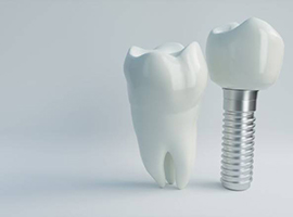 dental implant post with crown next to a natural tooth 