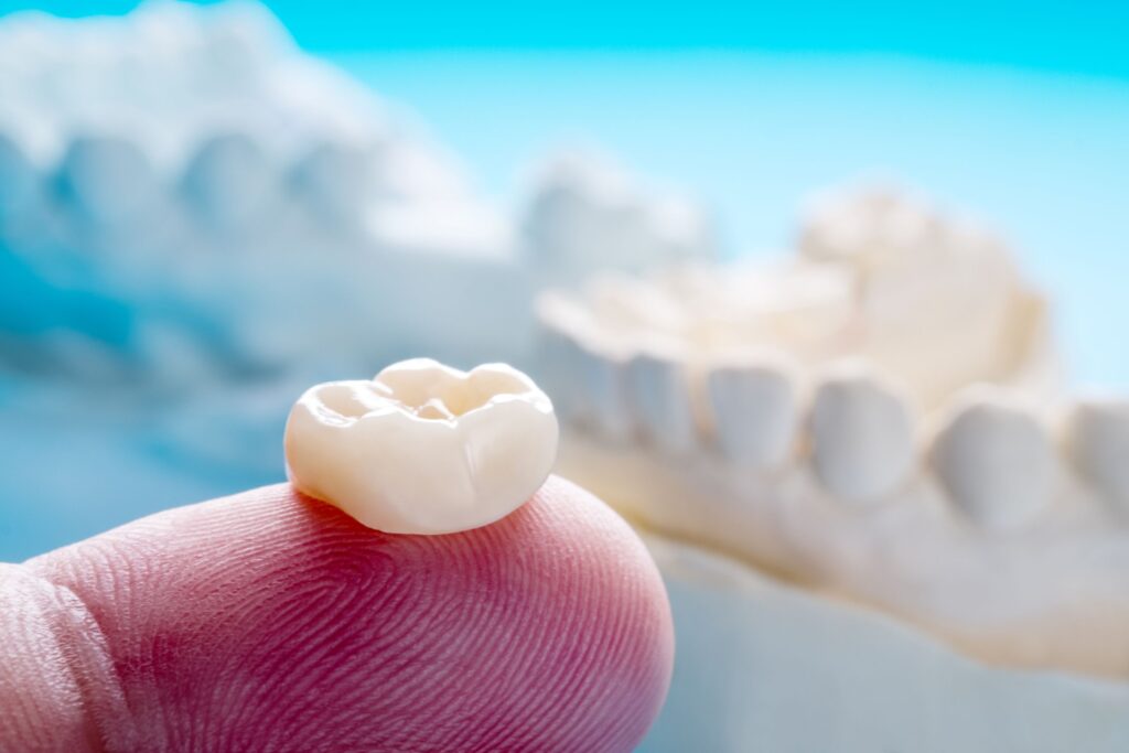 Dental crown sitting on a fingertip with a blue background
